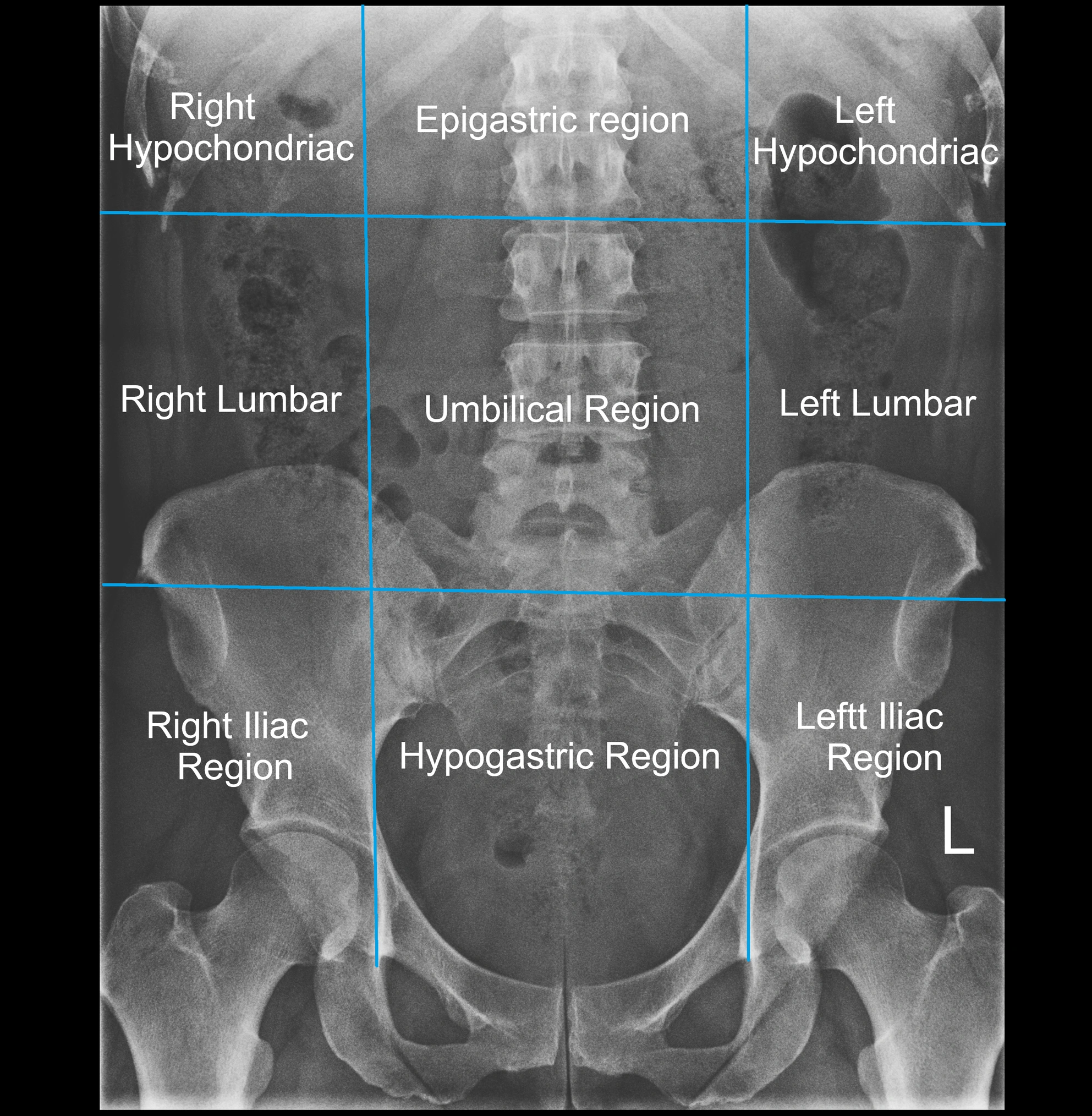 X Ray abdomen regions anatomy.webp